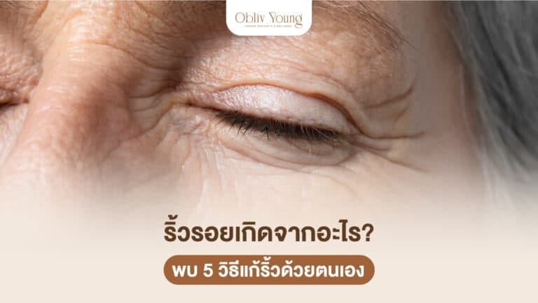 ริ้วรอยเกิดจากอะไร พบ 5 วิธีแก้ริ้วรอยด้วยตนเอง