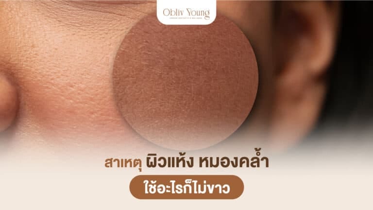 สาเหตุผิวแห้ง หมองคล้ำ ใช้อะไรก็ไม่ขาว