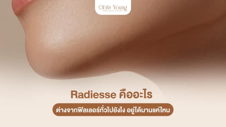 Radiesse คืออะไร ต่างจากฟิลเลอร์ทั่วไปยังไง อยู่ได้นานแค่ไหน