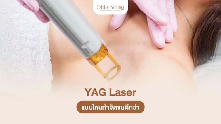 YAG Laser แบบไหนกำจัดขนดีกว่า