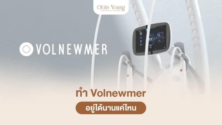 ทำ Volnewmer อยู่ได้นานแค่ไหน