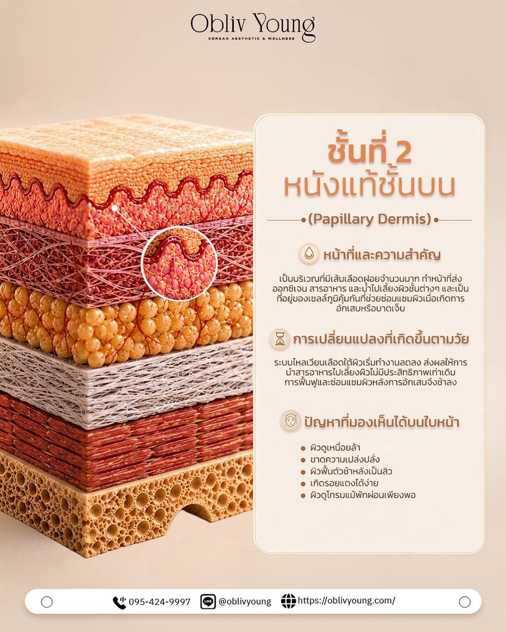 ชั้นที่ 2 หนังแท้ชั้นบน Papillary Dermis