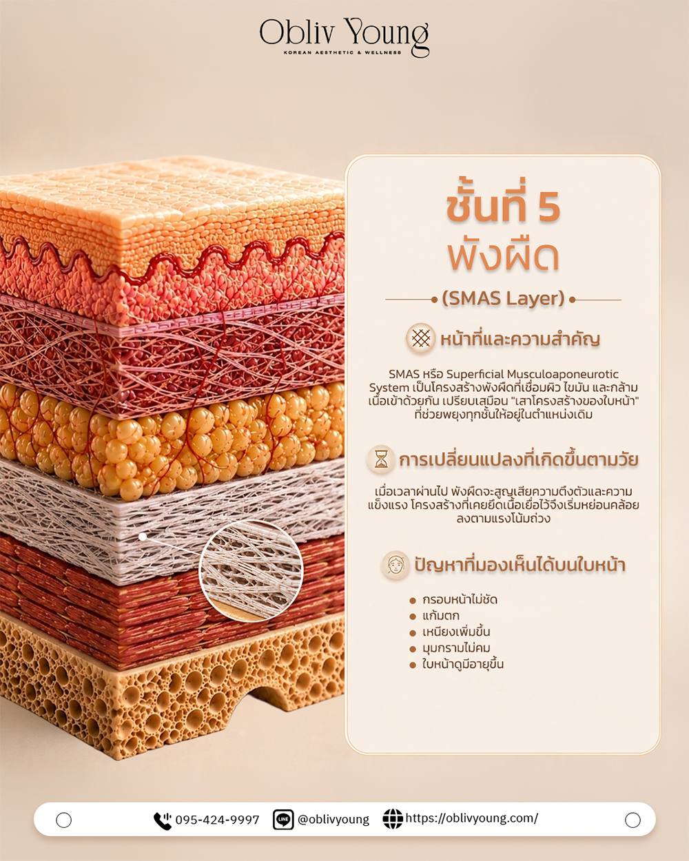 ชั้นที่ 5 พังผืด SMAS Layer