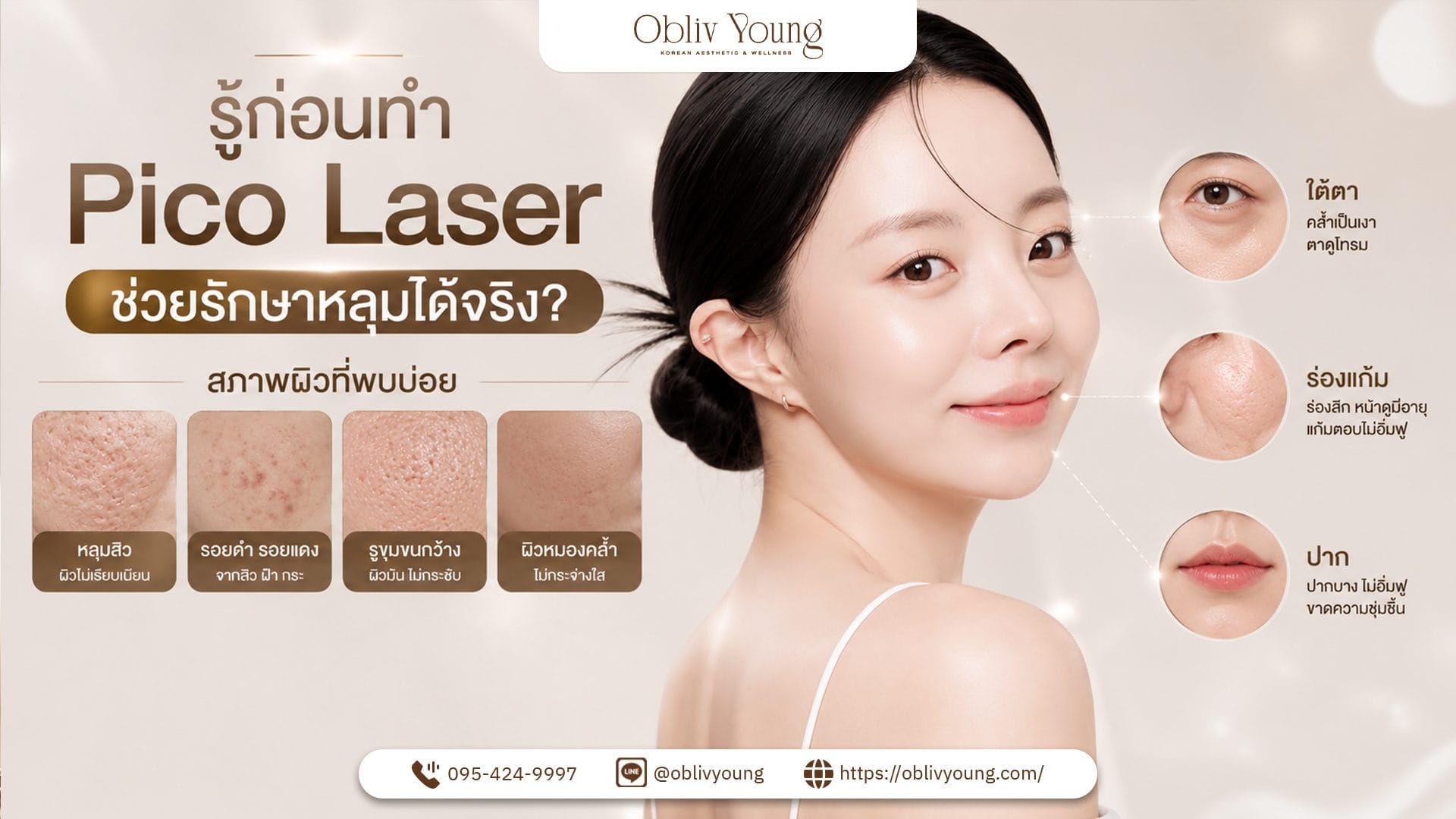 หลุมสิวรักษายังไง Pico Laser ช่วยได้แค่ไหน ก่อนทำต้องรู้อะไรบ้าง