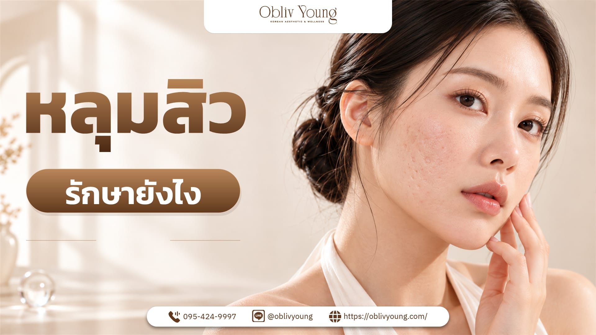 หลุมสิวรักษายังไง? ต้องดูอะไรก่อนเลือกวิธี