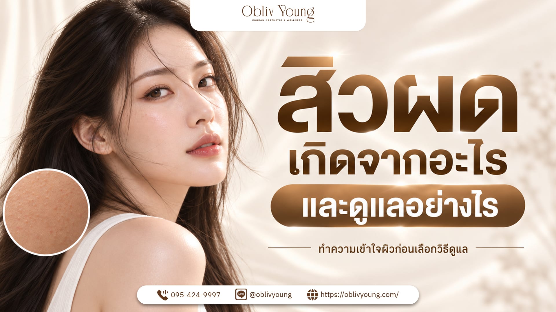 สิวผดเกิดจากอะไร และดูแลอย่างไร