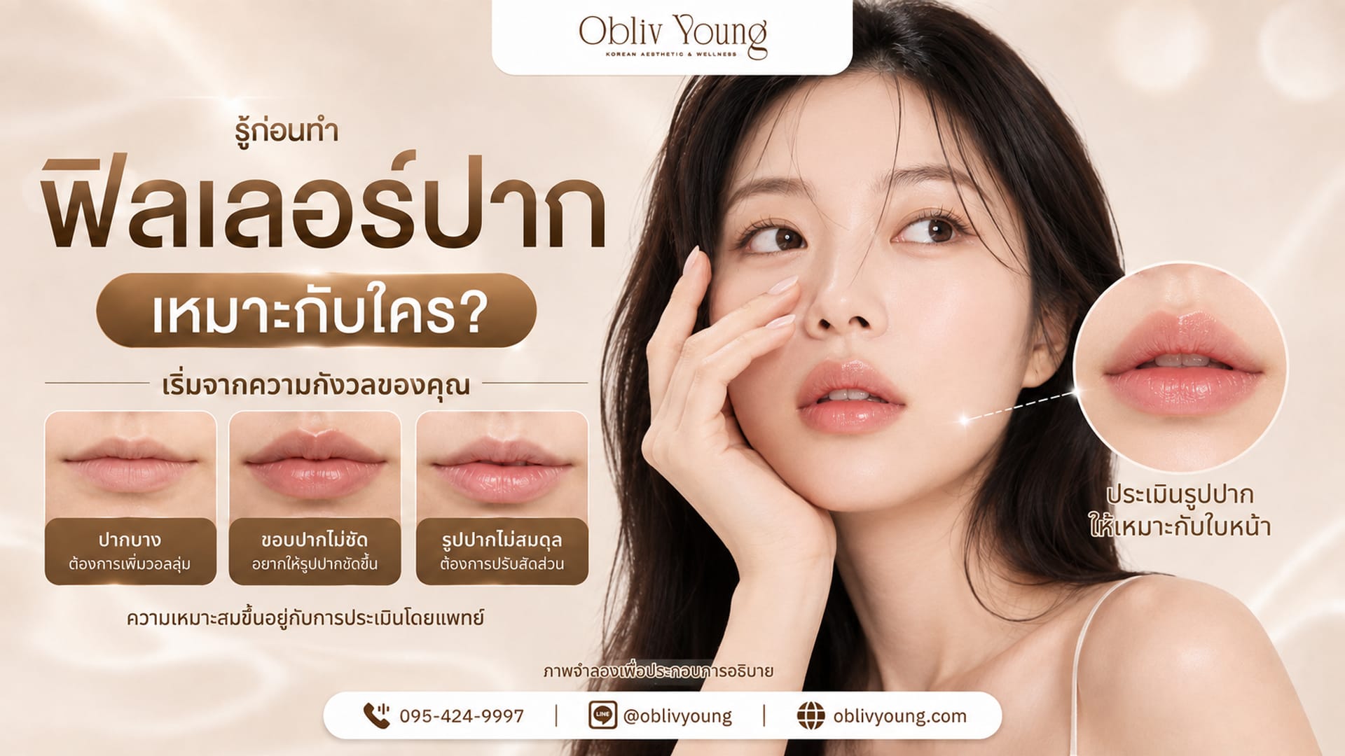 ฟิลเลอร์ปาก เหมาะกับใคร? ก่อนทำควรคุยอะไรกับแพทย์