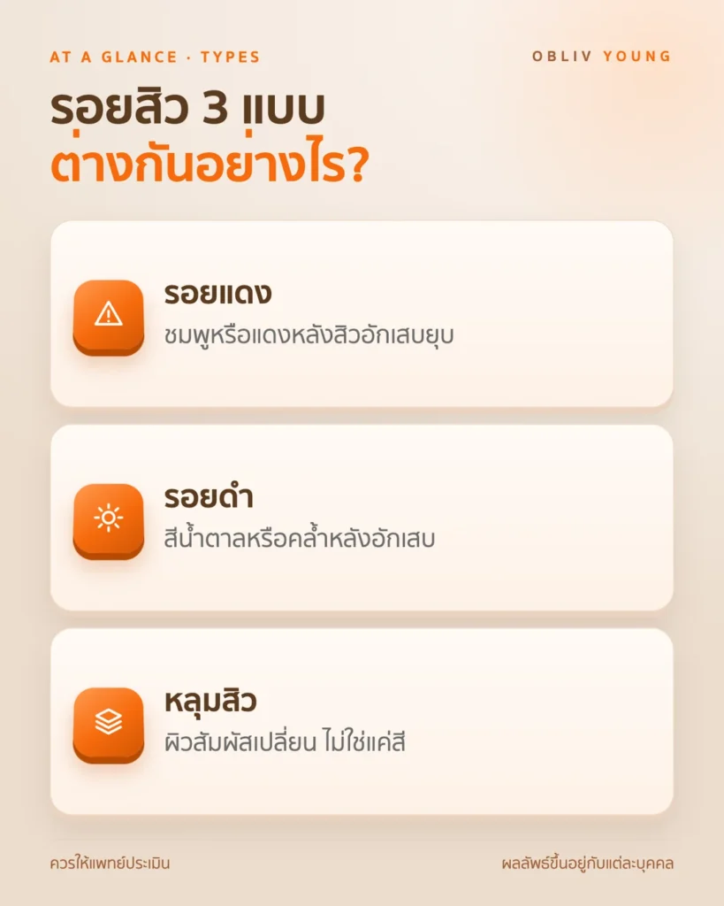 รอยสิว 3 แบบ: รอยแดง รอยดำ และหลุมสิวมีลักษณะต่างกัน