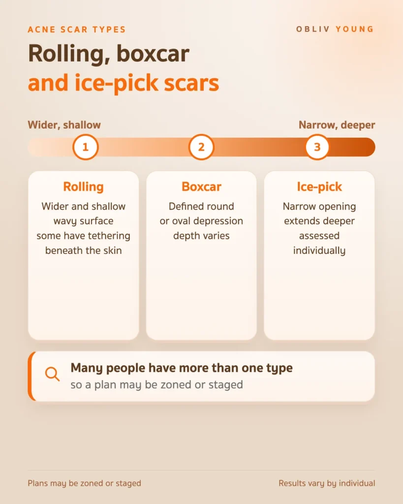 Rolling, boxcar and ice-pick acne scars compared, from wide and shallow depressions to narrow openings that extend deeper