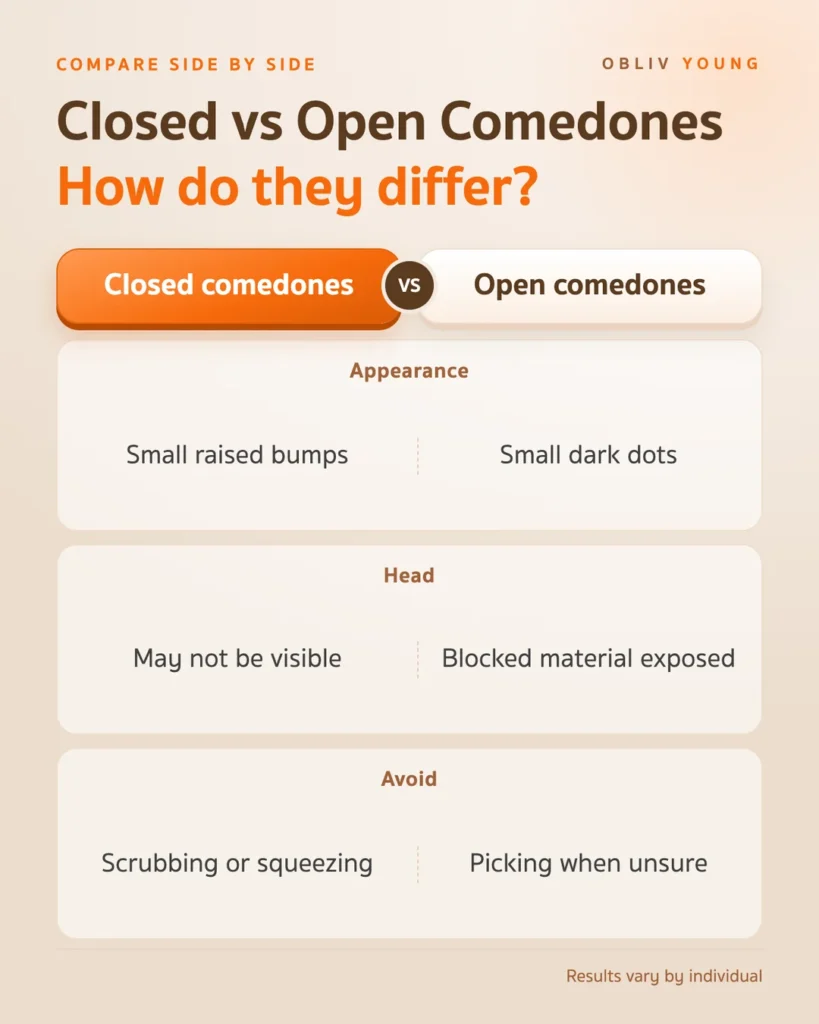 Closed and open comedones compared by appearance, visibility, and what to avoid