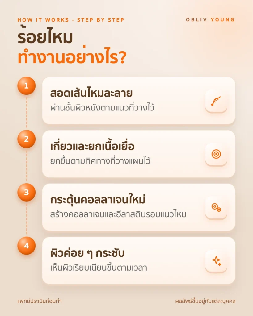 ร้อยไหมทำงานอย่างไร: สอดเส้นไหมละลายเพื่อยกเนื้อเยื่อและกระตุ้นคอลลาเจน