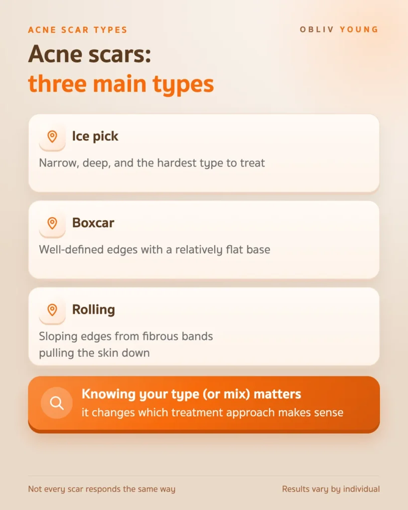Three types of atrophic acne scars, ice pick, boxcar and rolling, and why knowing your scar type changes the treatment approach